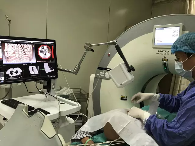 IQQA-Guide三維影像術(shù)中導(dǎo)航系統(tǒng)獲創(chuàng)新醫(yī)械特別審批，推動(dòng)精準(zhǔn)醫(yī)療新發(fā)展